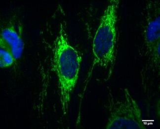 IDH2 Antibody in Immunocytochemistry (ICC/IF)