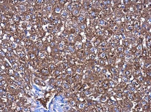 CBS Antibody in Immunohistochemistry (Paraffin) (IHC (P))