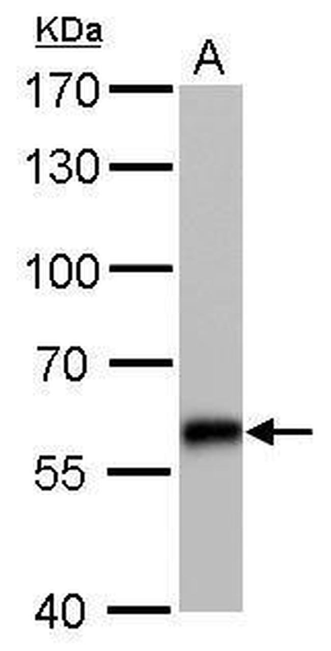 CBS Antibody in Western Blot (WB)