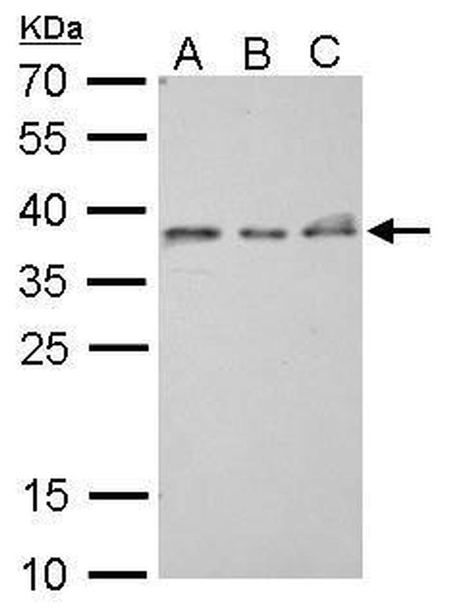 ZWINT Antibody in Western Blot (WB)