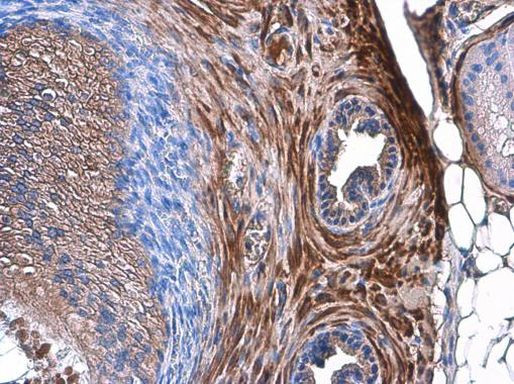 TAGLN Antibody in Immunohistochemistry (Paraffin) (IHC (P))