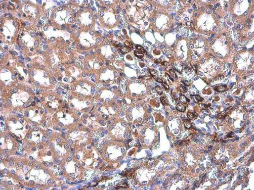 TAGLN Antibody in Immunohistochemistry (Paraffin) (IHC (P))