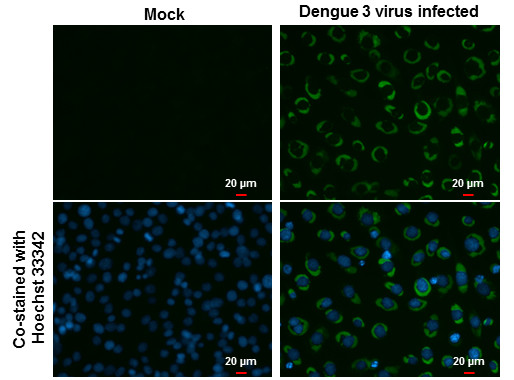 Dengue Virus Type 2 NS3 Monoclonal Antibody (GT2811) (MA5-17297)