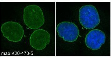 Nesprin 2 Monoclonal Antibody (K20-478-5) (MA5-18075)