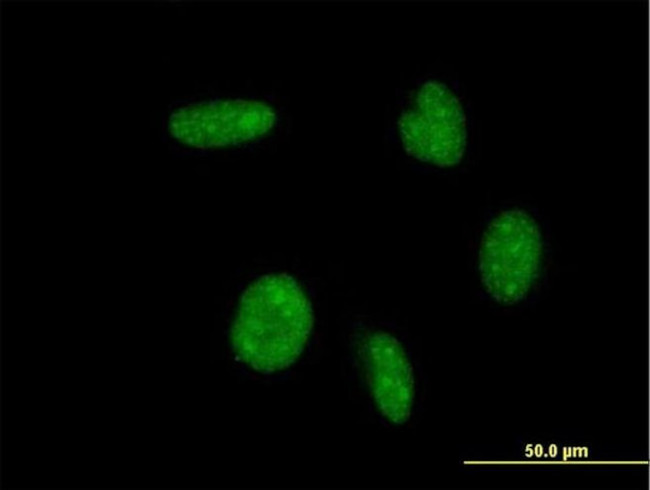 MATH1 Monoclonal Antibody (4H2) (MA5-18449)