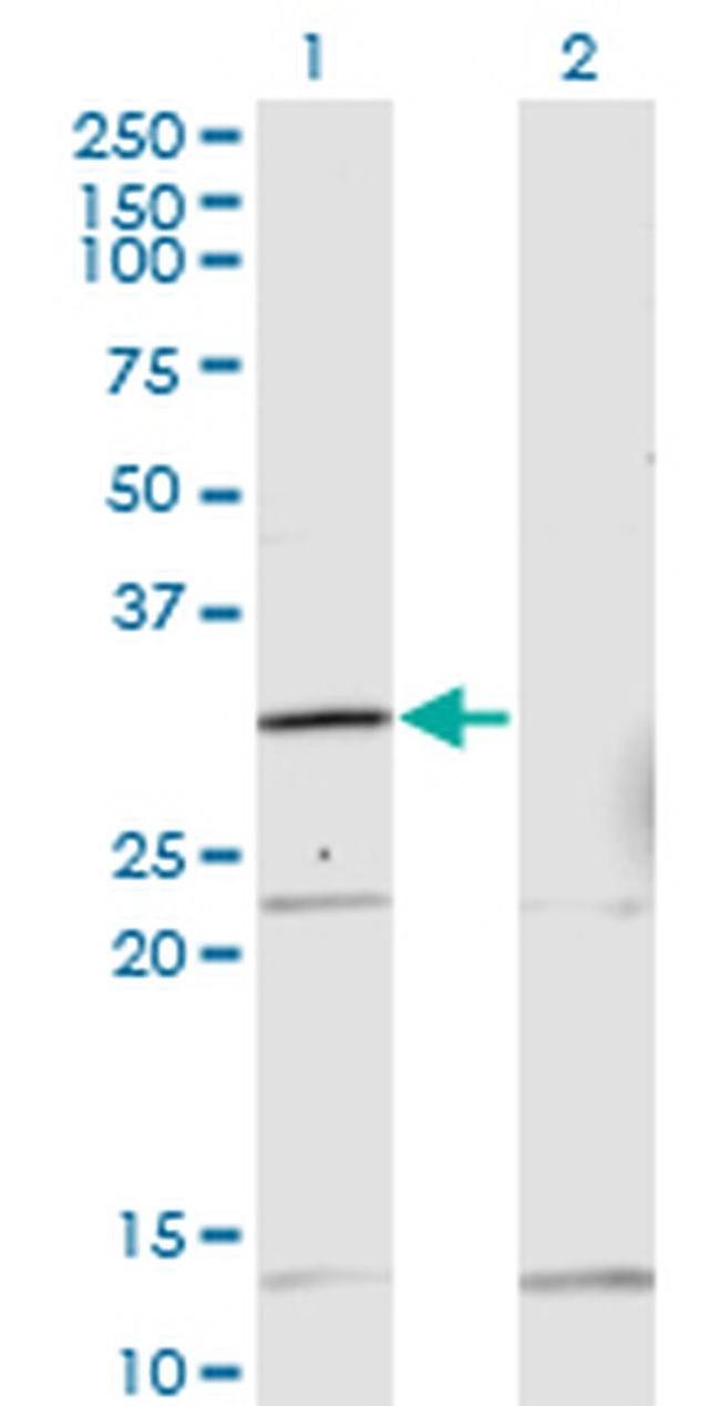 HOXA1/HOXB1/HOXD1 Antibody in Western Blot (WB)