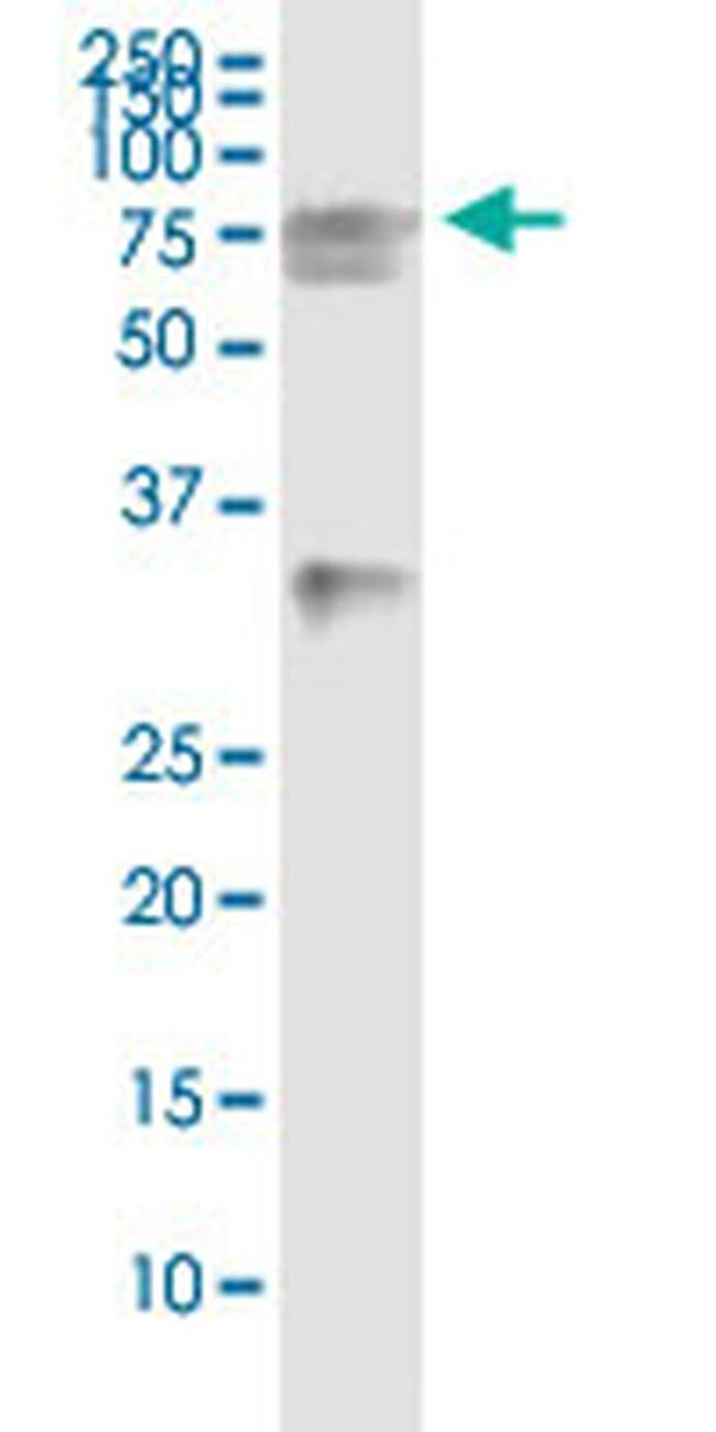 HSPA2 Antibody in Immunoprecipitation (IP)