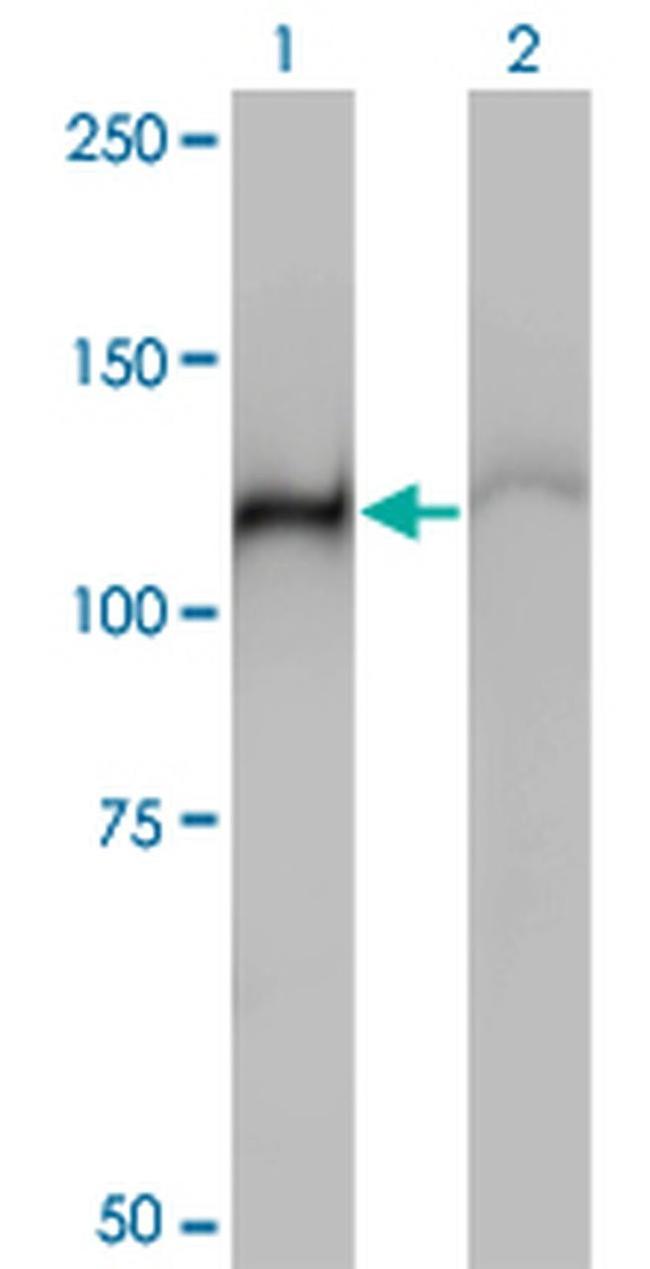 HSPA4 Antibody in Western Blot (WB)