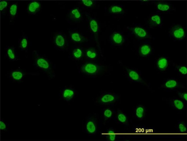 NFIC Antibody in Immunocytochemistry (ICC/IF)