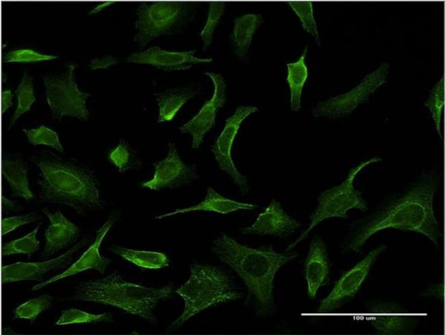 PHKG2 Antibody in Immunocytochemistry (ICC/IF)