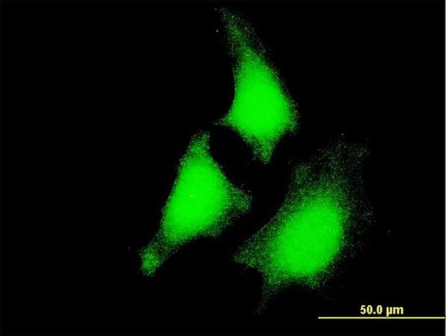 MEK5 Antibody in Immunocytochemistry (ICC/IF)