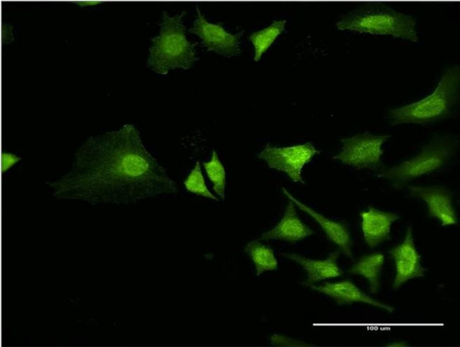 RING1 Antibody in Immunocytochemistry (ICC/IF)