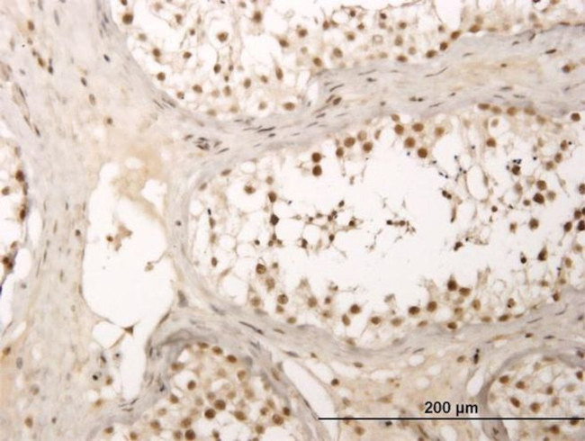 ZNF213 Antibody in Immunohistochemistry (PFA fixed) (IHC (PFA))