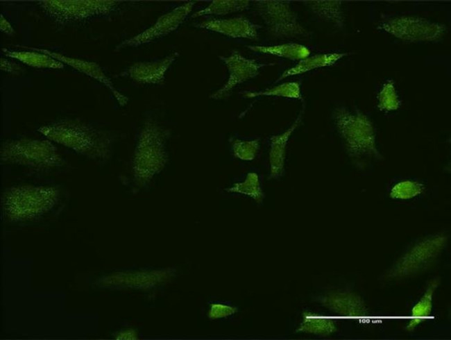 EMAP II Antibody in Immunocytochemistry (ICC/IF)