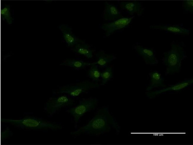 SH2D3A Antibody in Immunocytochemistry (ICC/IF)