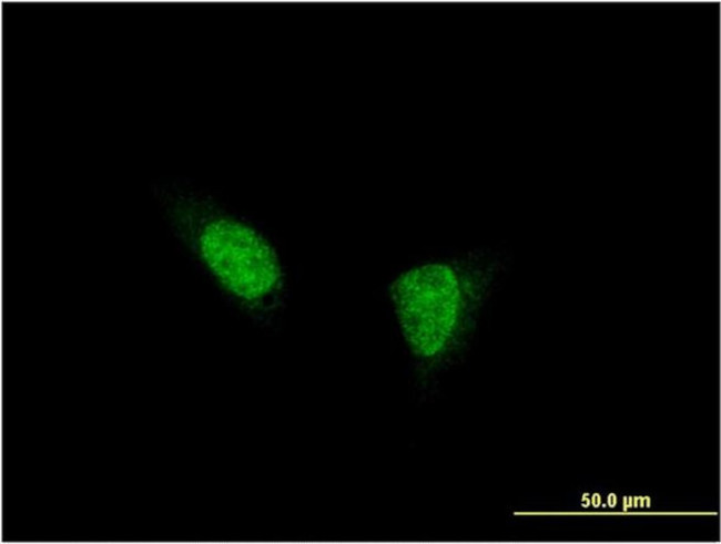 TSHZ1 Antibody in Immunocytochemistry (ICC/IF)