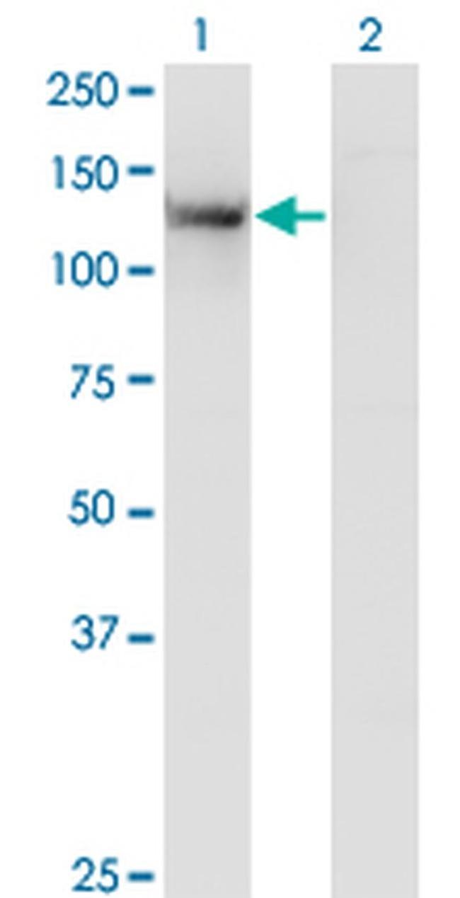 TSHZ1 Antibody in Western Blot (WB)