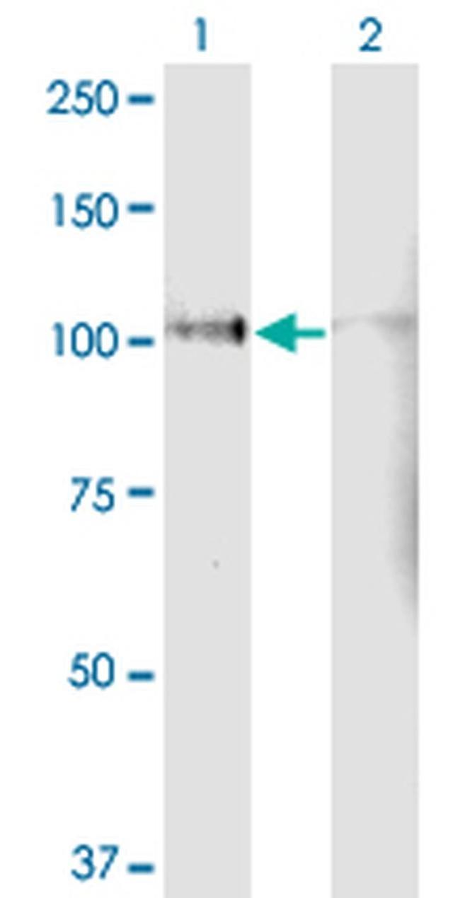 LPIN1 Antibody in Western Blot (WB)