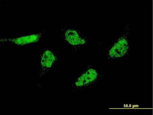 FAM215A Antibody in Immunocytochemistry (ICC/IF)