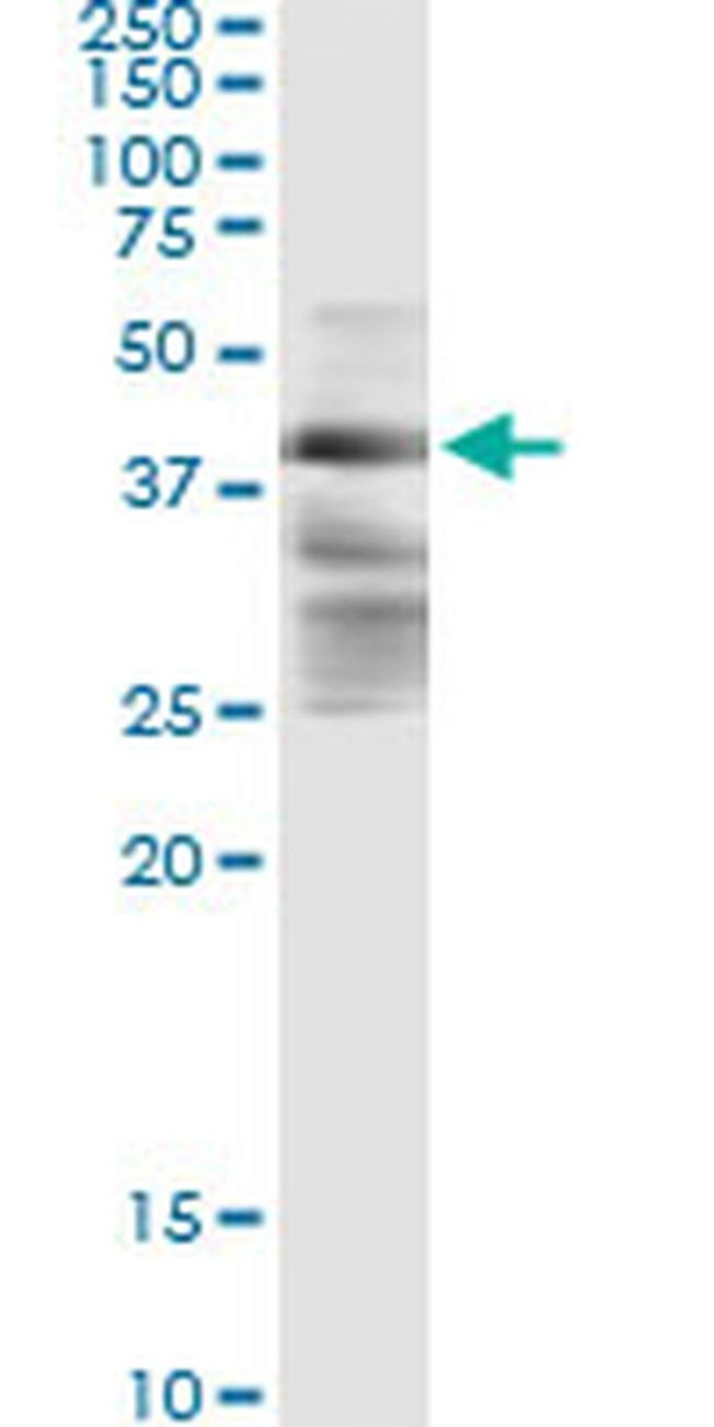 ZFYVE19 Antibody in Immunoprecipitation (IP)