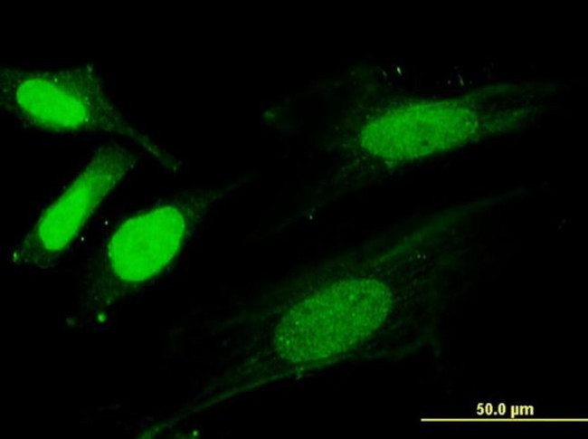 SNX20 Antibody in Immunocytochemistry (ICC/IF)