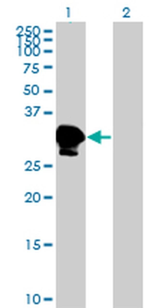 ZNF396 Antibody in Western Blot (WB)