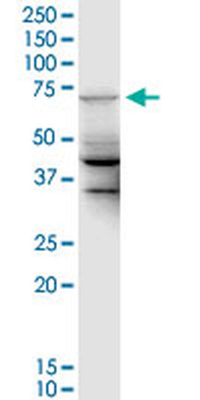 UBE2DNL Antibody in Western Blot (WB)