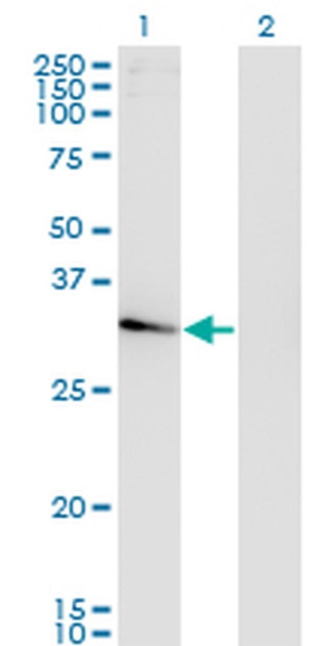NACA2 Antibody in Western Blot (WB)