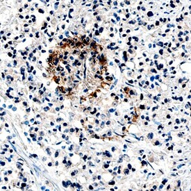 Angiopoietin 1 Antibody in Immunohistochemistry (Paraffin) (IHC (P))