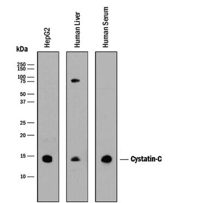 Cystatin C Antibody in Western Blot (WB)