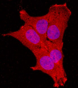 MAGED1 Antibody in Immunocytochemistry (ICC/IF)