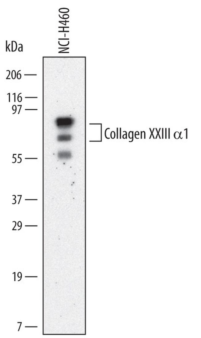 COL23A1 Antibody in Western Blot (WB)