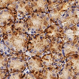 Laminin alpha-3 Antibody in Immunohistochemistry (Paraffin) (IHC (P))