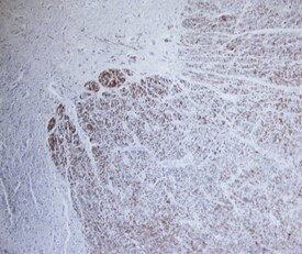 FABP8 Antibody in Immunohistochemistry (Paraffin) (IHC (P))