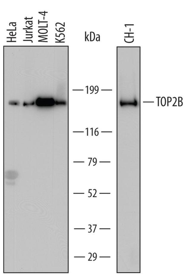 TOP2B Monoclonal Antibody (681417) (MA5-24310)