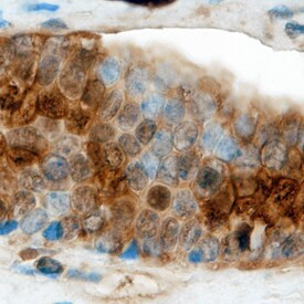 Claudin 19 Antibody in Immunohistochemistry (Paraffin) (IHC (P))