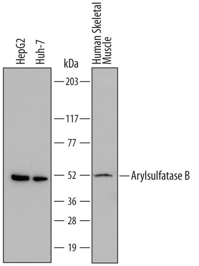 Arylsulfatase B Antibody in Western Blot (WB)