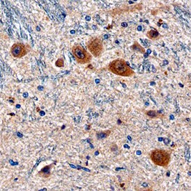 LRP4 Antibody in Immunohistochemistry (Paraffin) (IHC (P))