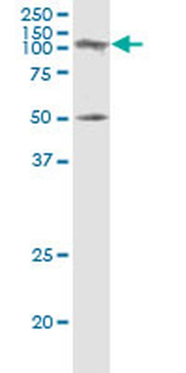 SAGE1 Antibody in Western Blot (WB)