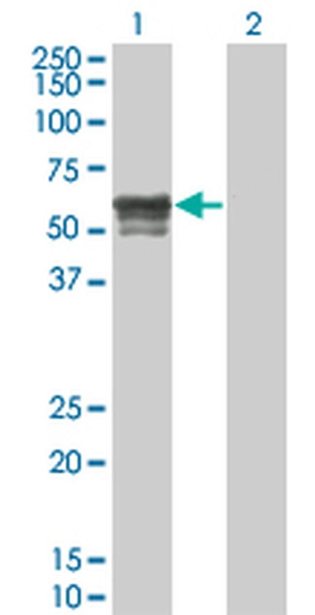 IRX6 Antibody in Western Blot (WB)