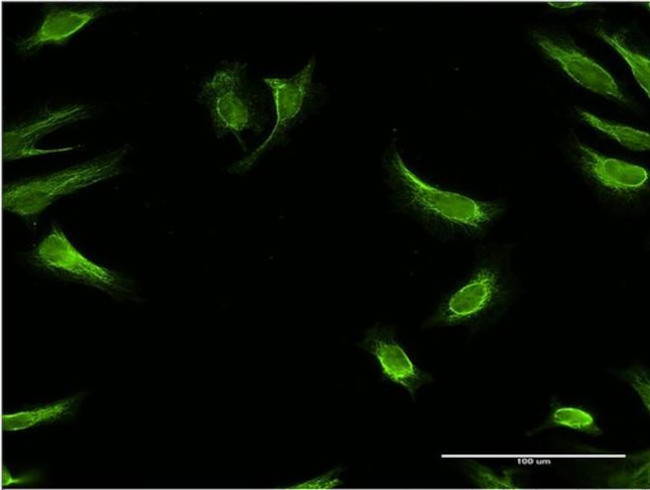 RBP7 Antibody in Immunocytochemistry (ICC/IF)