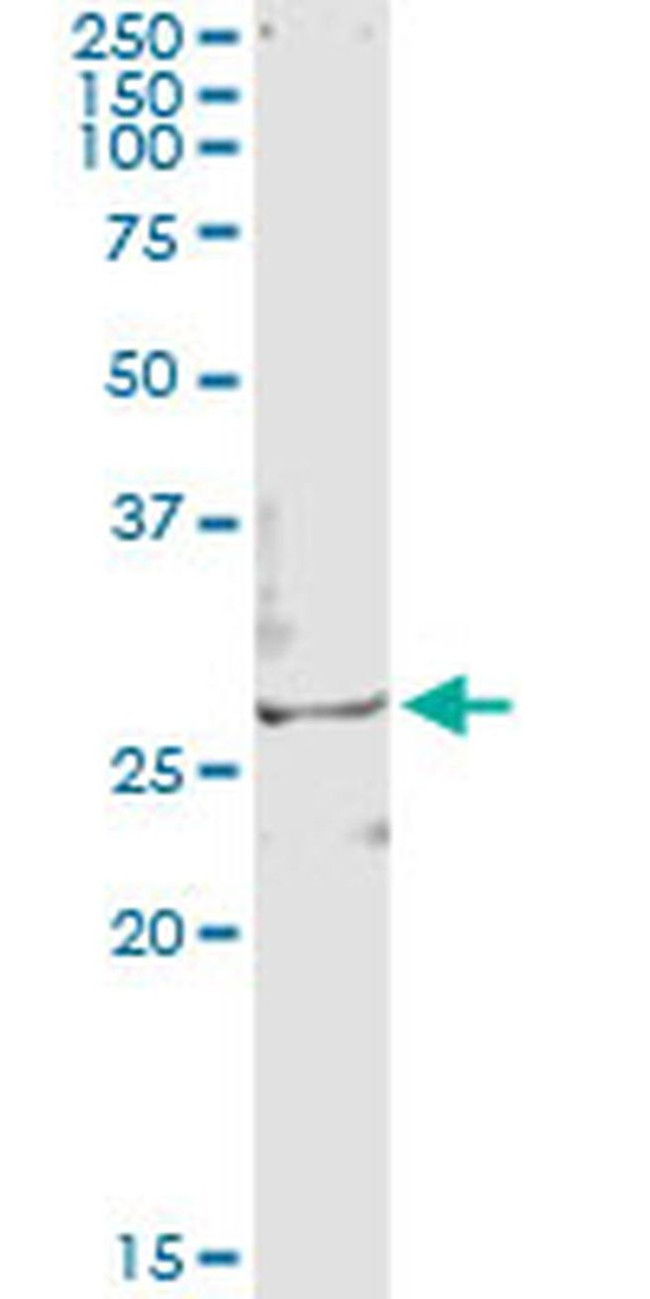 TSSK3 Antibody in Immunoprecipitation (IP)