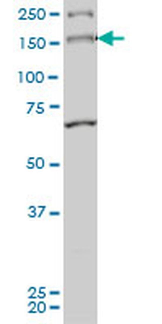 MYO3A Antibody in Western Blot (WB)