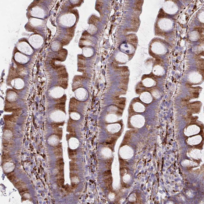 P4HA2 Antibody in Immunohistochemistry (IHC)