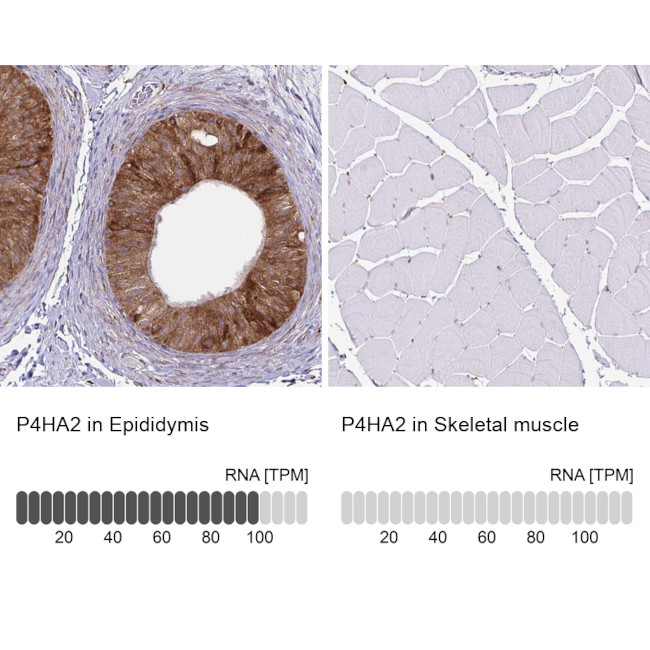 P4HA2 Antibody