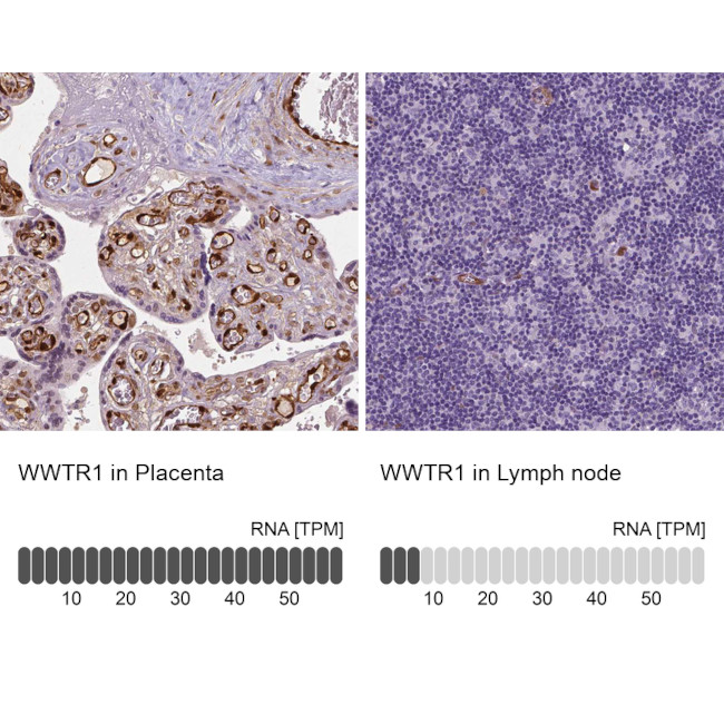 WWTR1 Antibody in Immunohistochemistry (IHC)