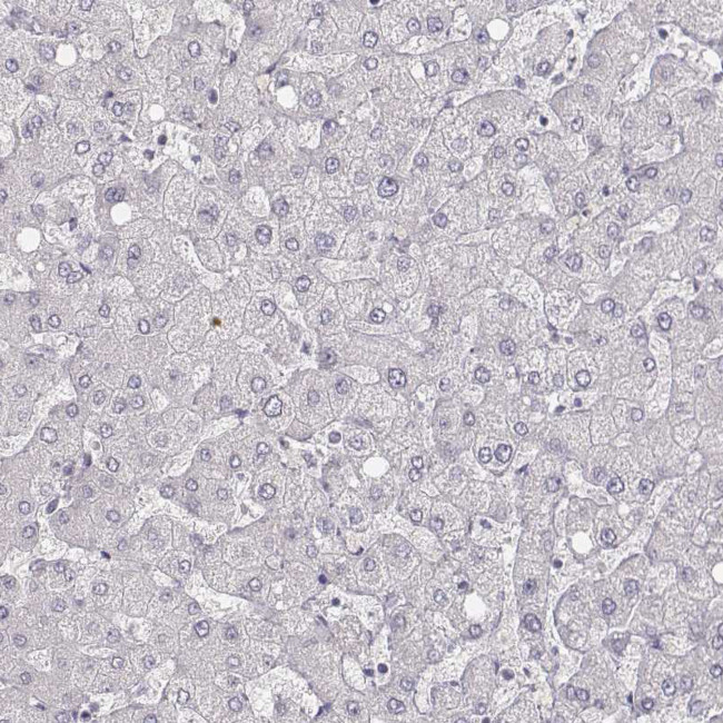 MYH6 Antibody in Immunohistochemistry (IHC)