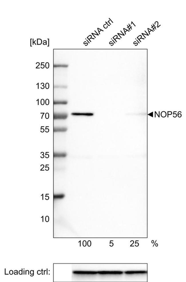 NOP56 Antibody in Western Blot (WB)