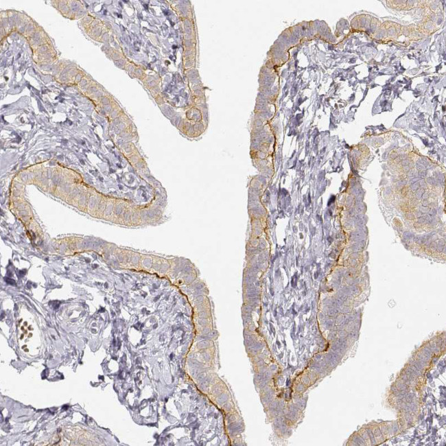 Laminin gamma-2 Antibody in Immunohistochemistry (IHC)