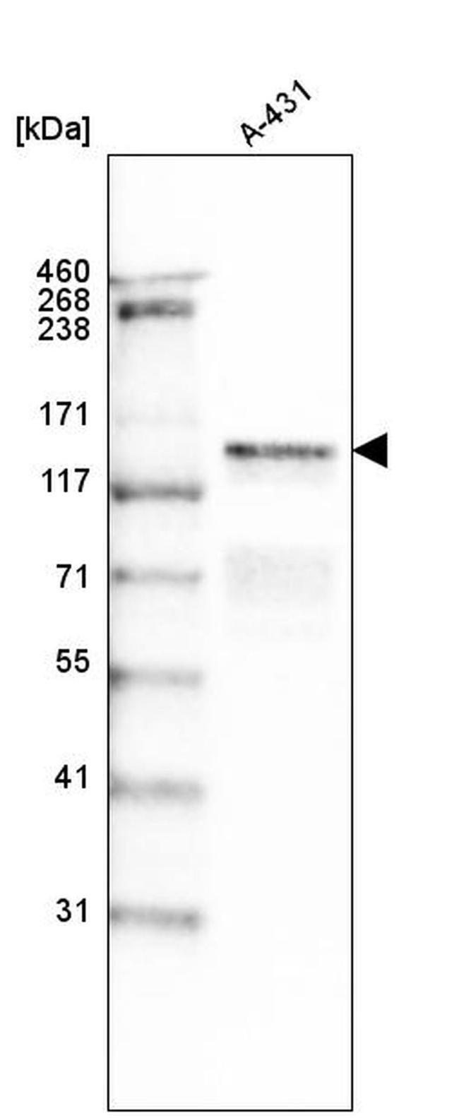 Laminin gamma-2 Antibody in Western Blot (WB)
